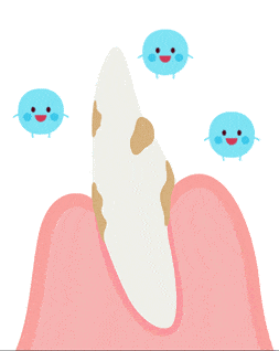 GIF